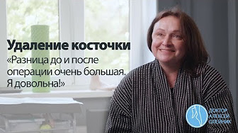 КОСТОЧКИ НА НОГАХ: "Разница до и после операции очень большая. Я довольна!"