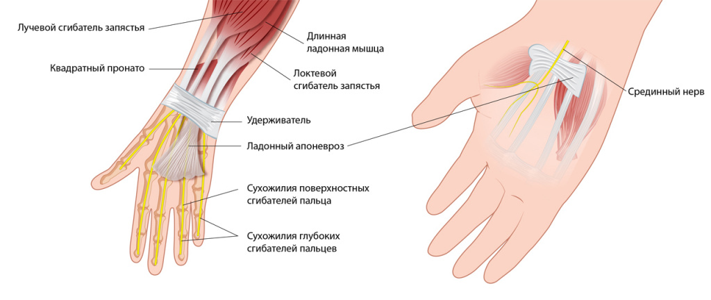 Синдром запястного канала2-01.jpg